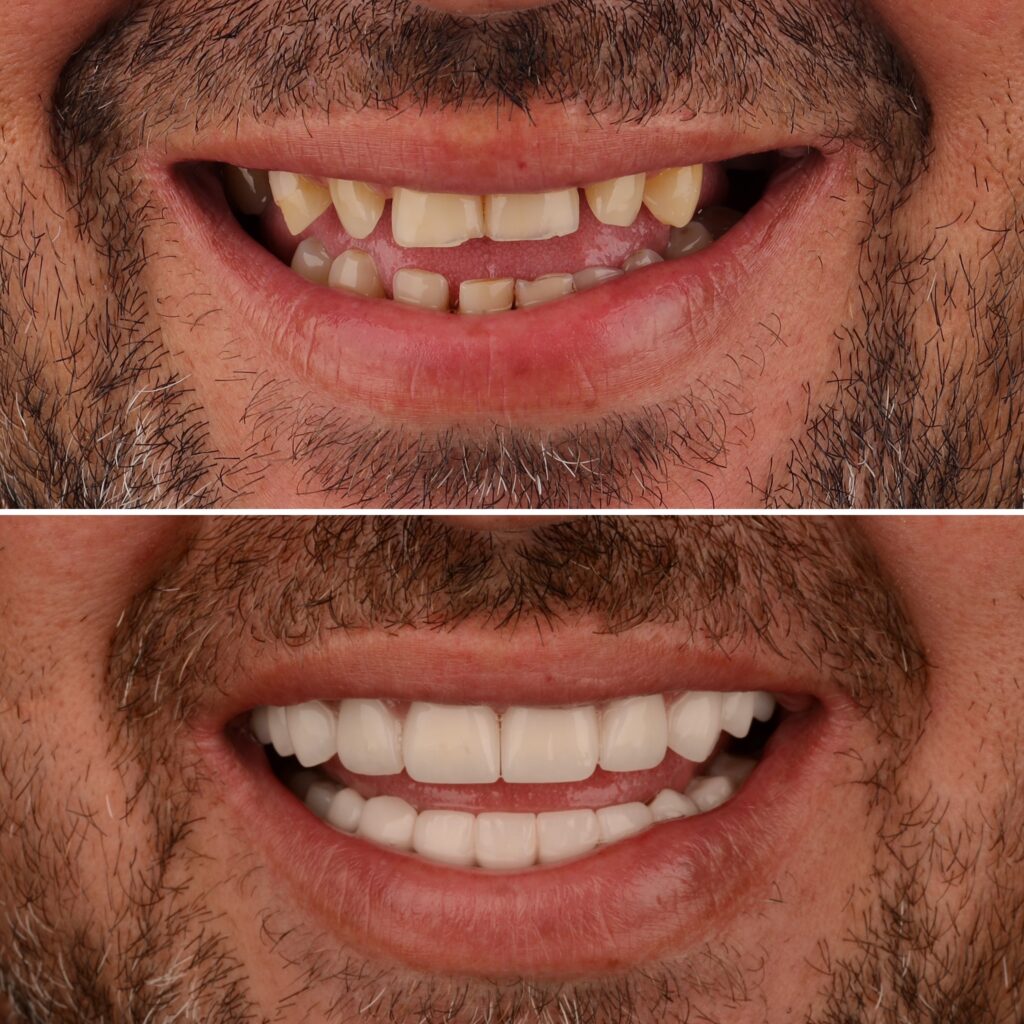 19375c30 c077 46e3 943d 17a960e02db6