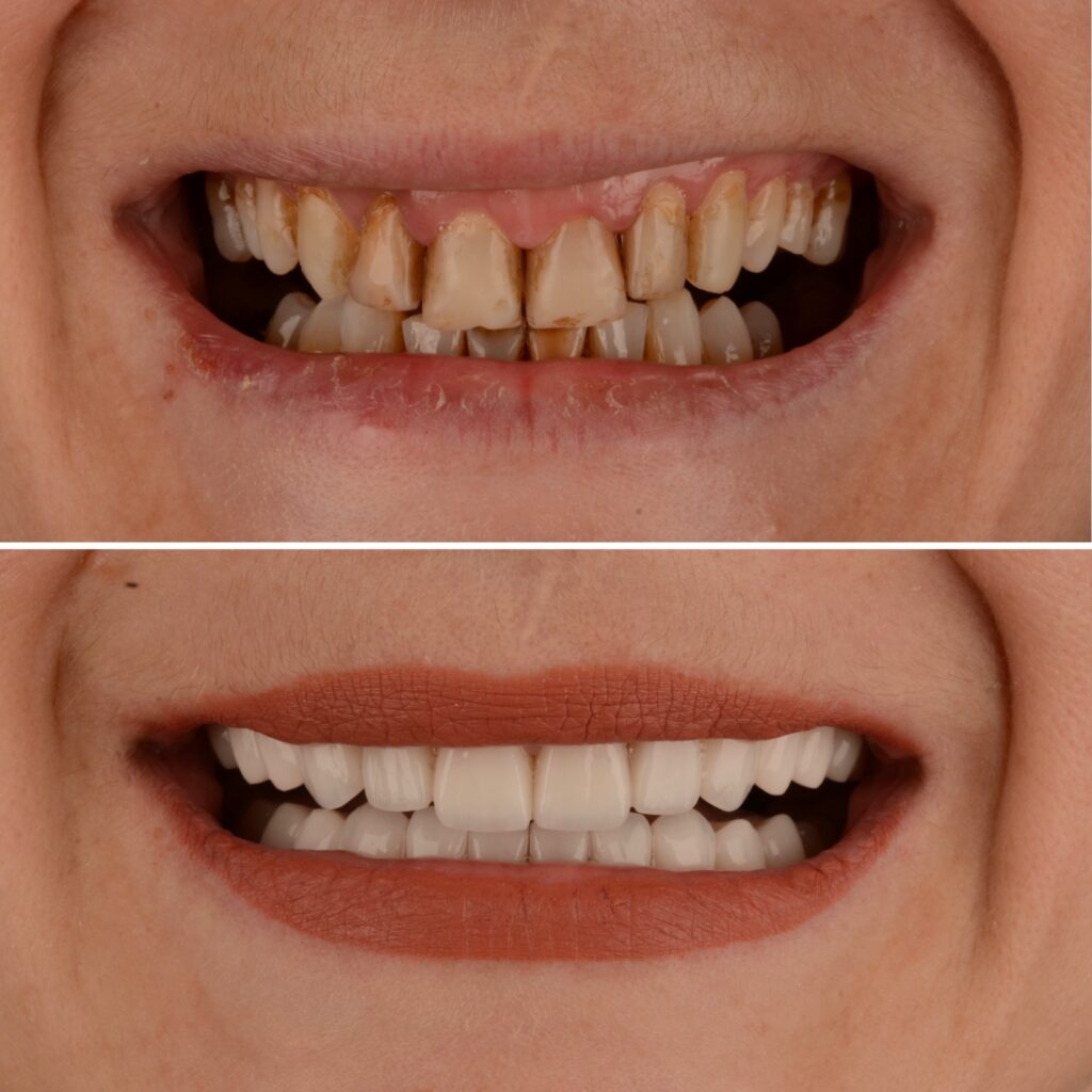 90d592fd 9955 45b9 b67a 3f0ef16742b9