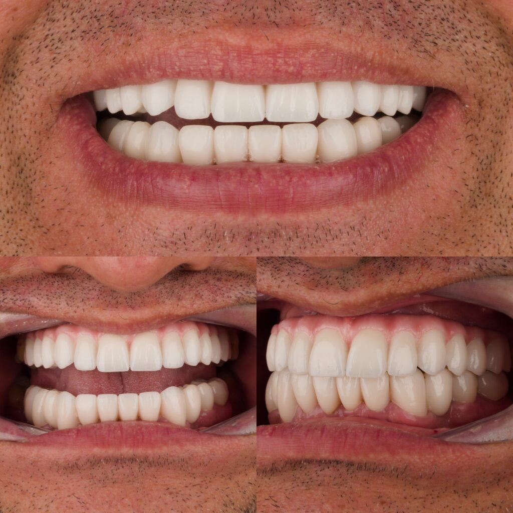 cbff2488 50b2 4452 a36d 2a4cb085f922