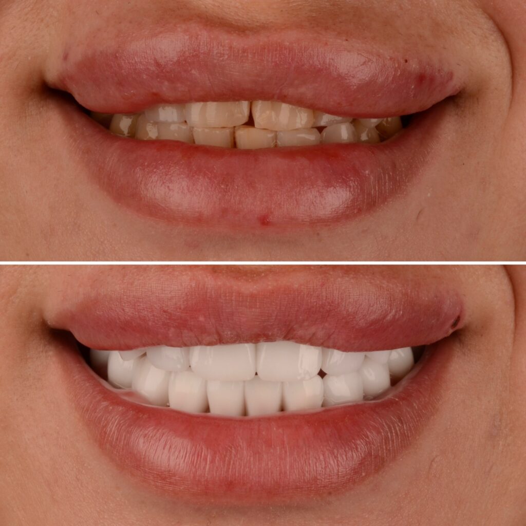 d01daf7d bddc 441d a8f5 66ef1e2355bf