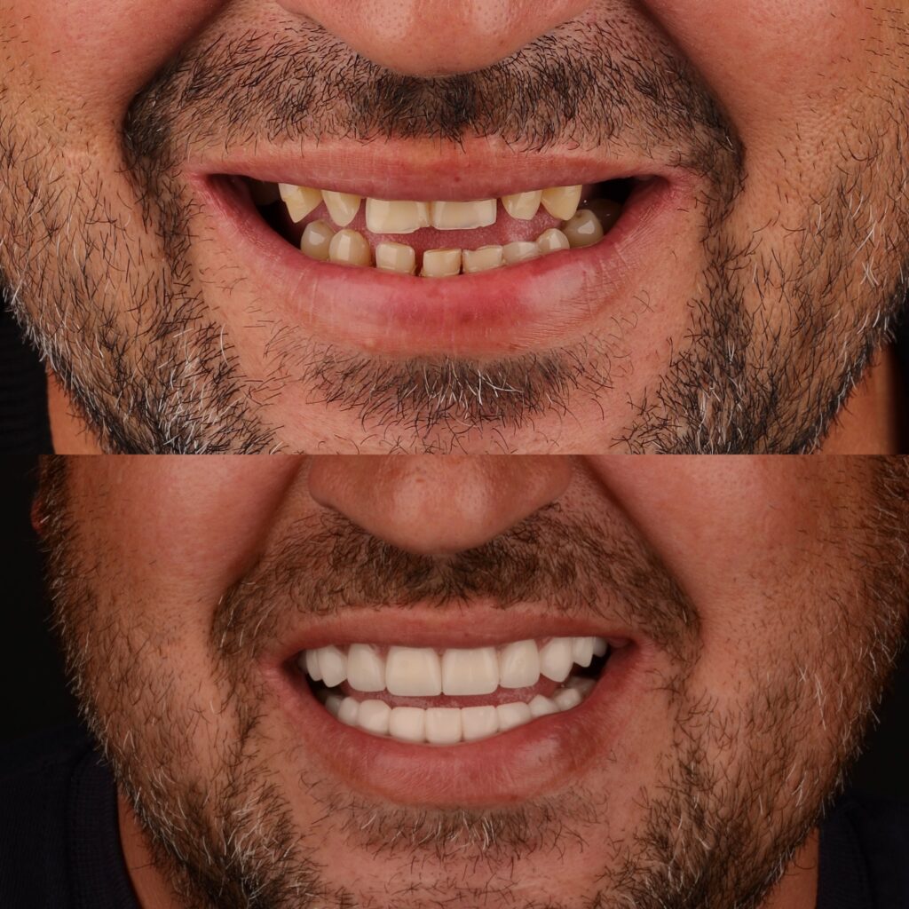 f6df892b e3c9 409a b5fe aeccbd1f94ca